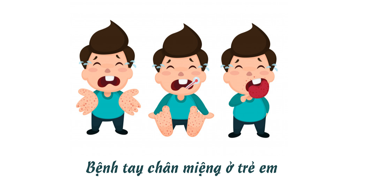 image-20230623101419-2-1 Benh TCM