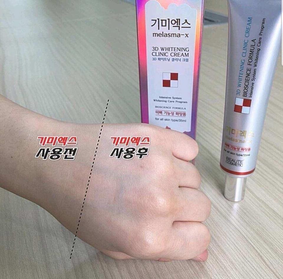kem-tri-nam-3d-whitening-clinic-cream-review-2 Kem trọ nám 3D Whitening Clinic Cream sở hữu công dụng cao trong hỗ trợ điều trị nám trên da